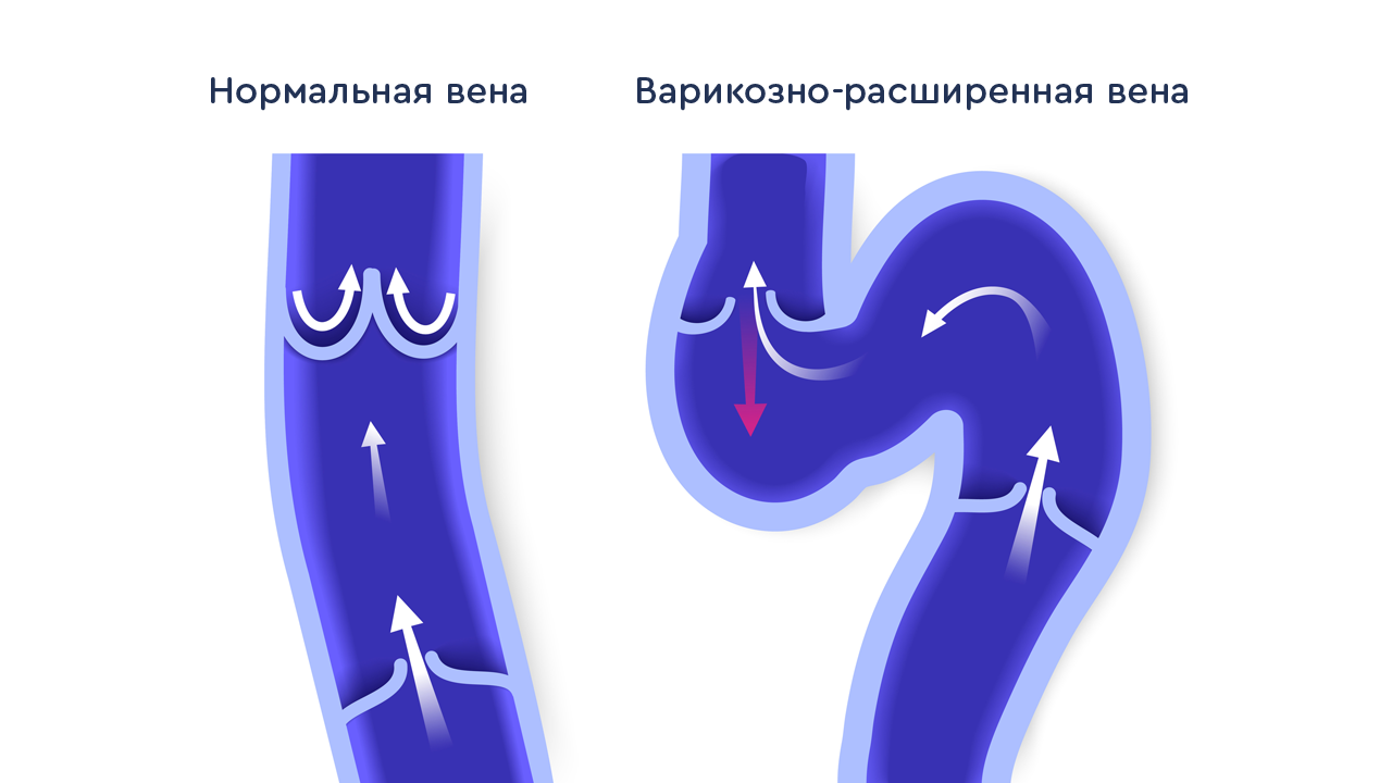 функции клапанов вен
