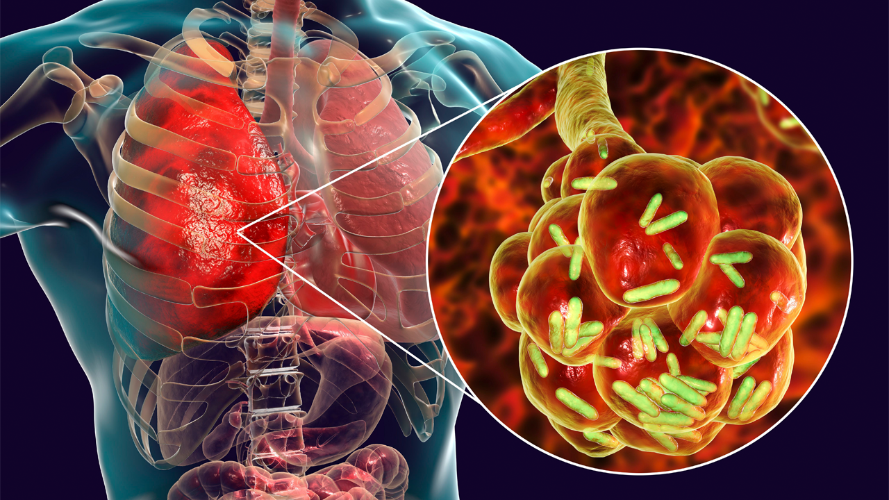 Болезнь_вызывают_M_pneumoniae_–_наиболее_опасные_штаммы_микоплазмы